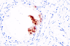 CXCL10 (F9N8I) Rabbit mAb #45008